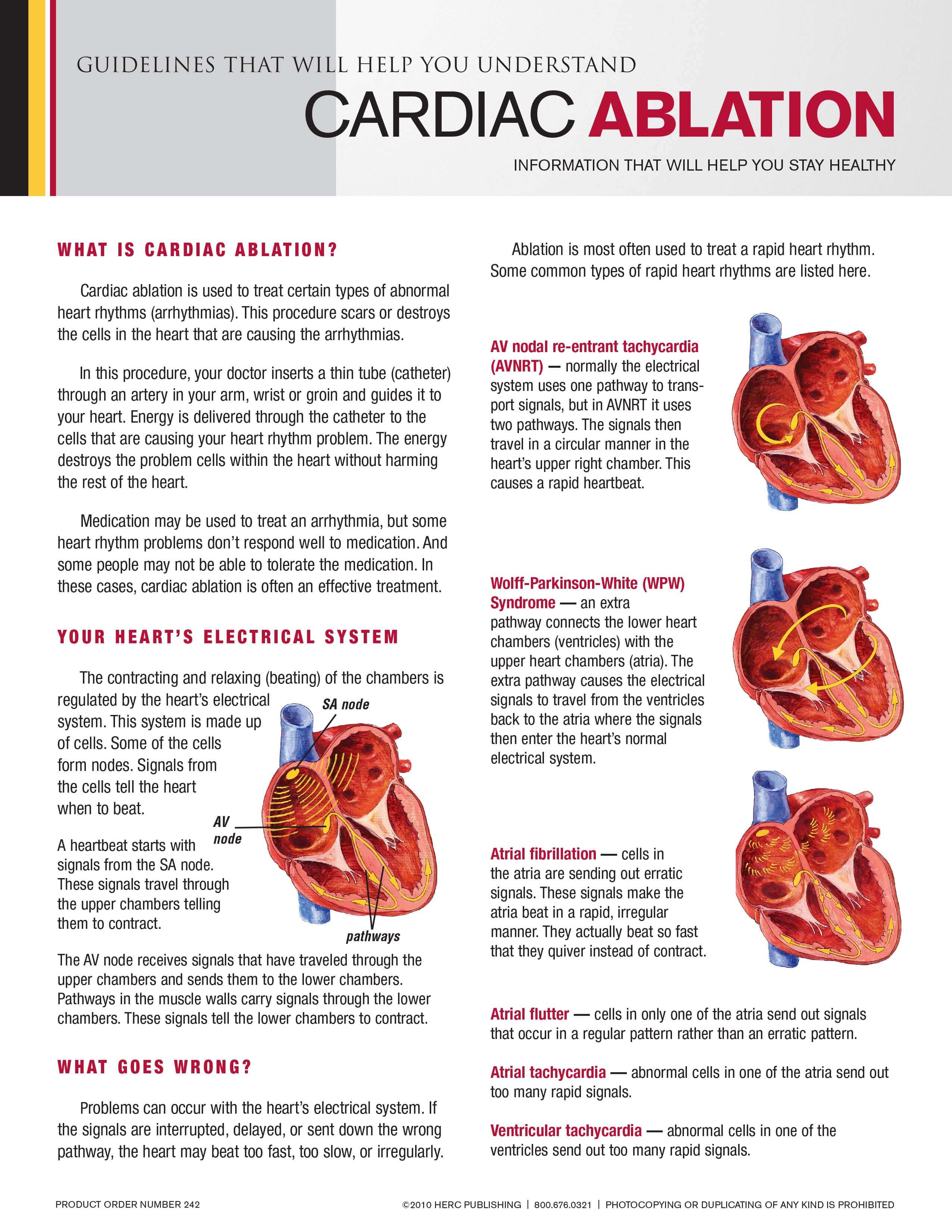 cardiac-ablation-herc-publishing